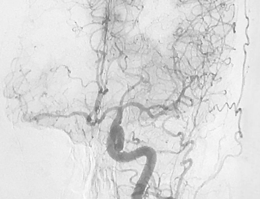 Ιωάννης Σαχμπαζίδης MD, MSc