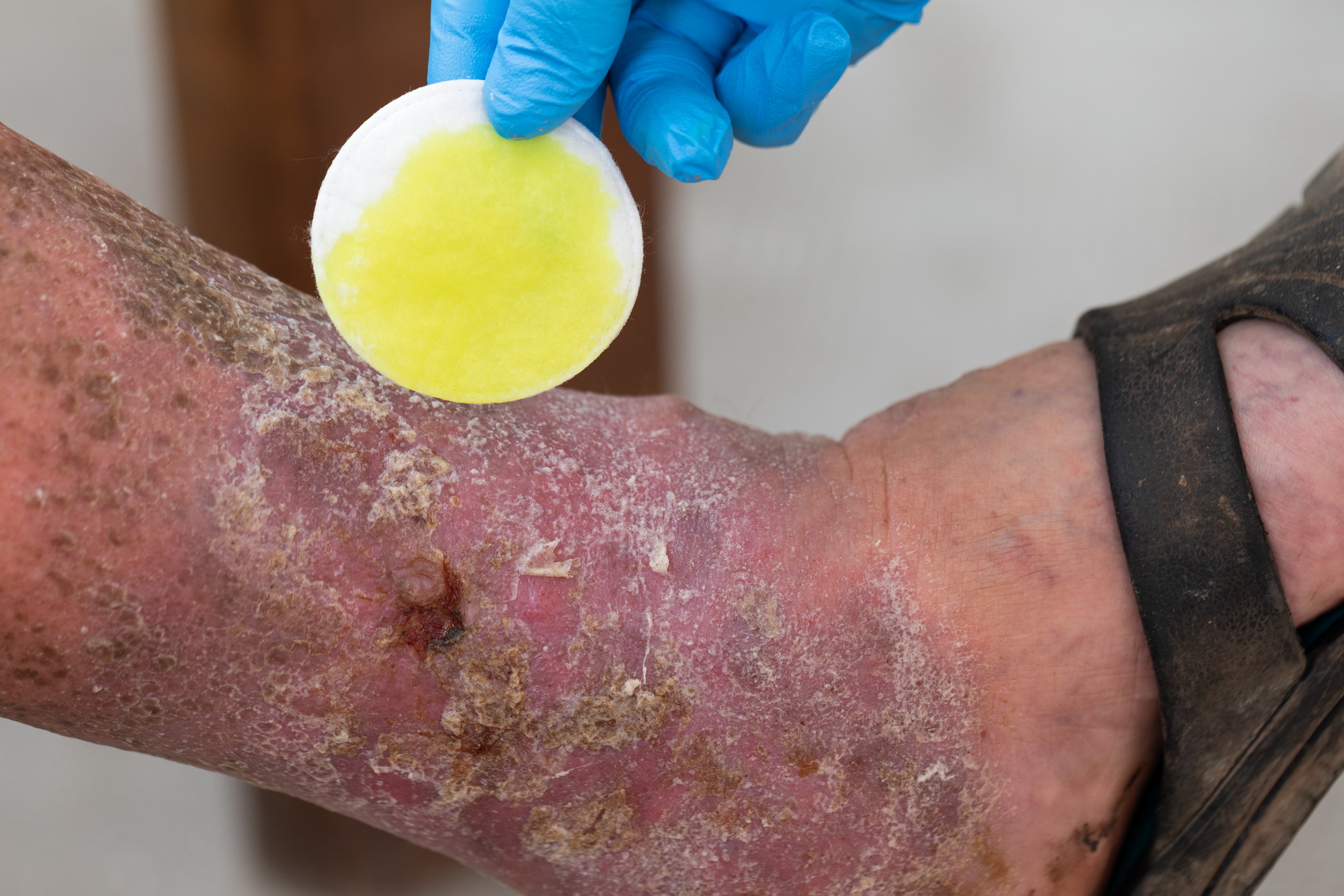 Ιωάννης Σαχμπαζίδης MD, MSc